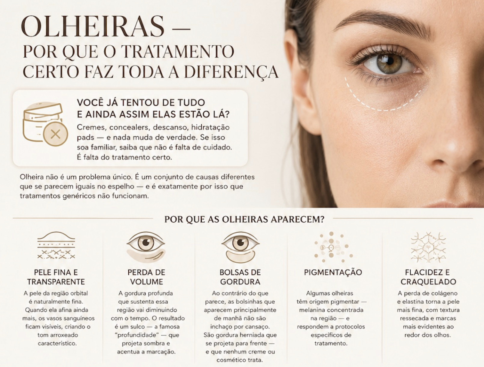 Por que as olheiras aparecem — pele fina, perda de volume, bolsas de gordura, pigmentação e flacidez