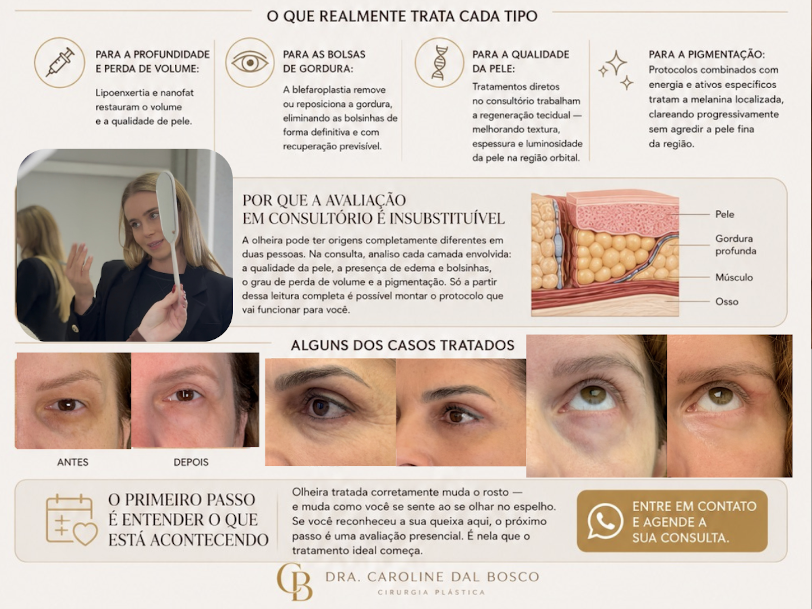 O que realmente trata cada tipo de olheira — protocolos por causa e avaliação em consultório